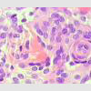Histologischer Befund Histologischer Befund